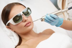 Lifting-laser-Fotona-4D